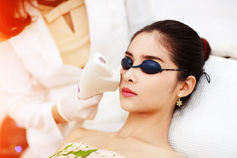Laser rejuvenation